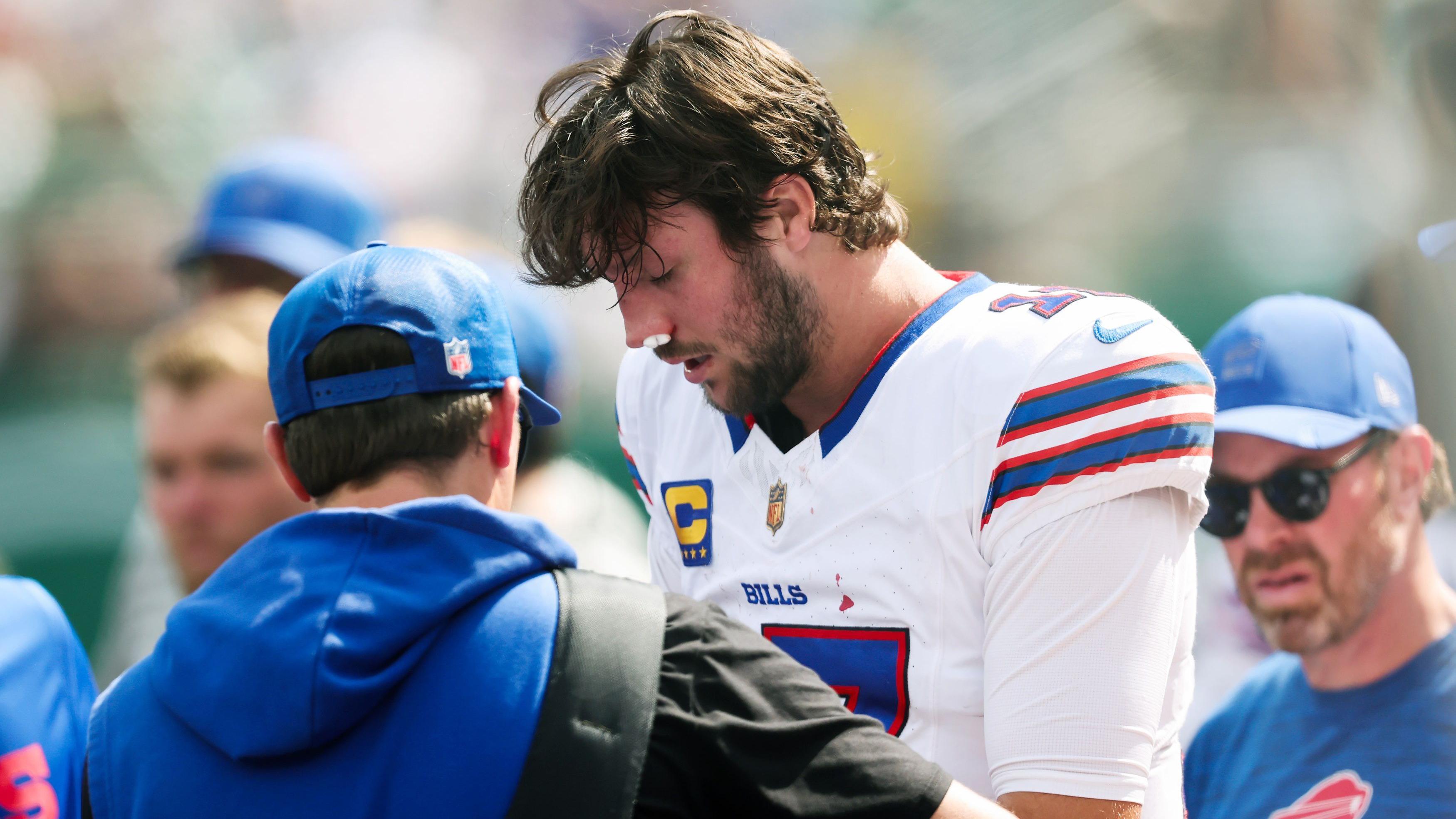 Bufalo Bills quarterback Josh Allen gets treatment for a nose injury