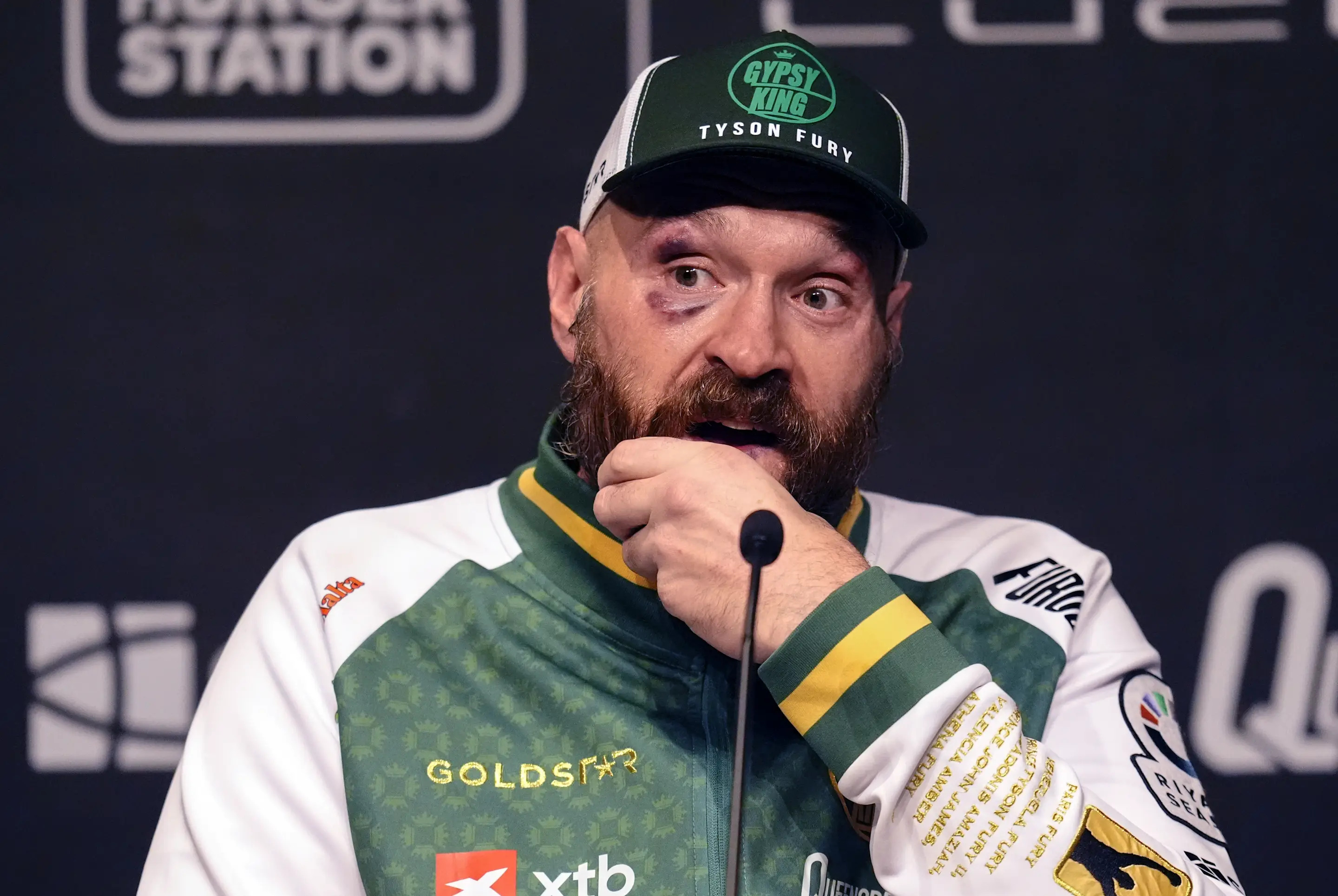 Tyson Fury during a press conference following his defeat to Oleksandr Usyk at the Kingdom Arena in Riyadh, Saudi Arabia. Picture date: Saturday December 21, 2024. (Photo by Nick Potts/PA Images via Getty Images)