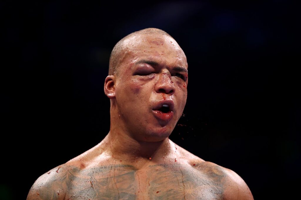 Was Wardley vs Dubois stopped too late? Bloody duel reveals controversial truth Was Wardley vs Dubois stopped too late? Bloody duel reveals controversial truth