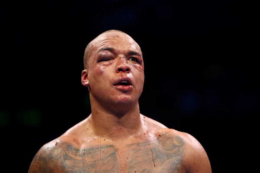 Daniel Dubois’ bludgeoning of Fabio Wardley is a sobering reminder of boxing’s bravery complex