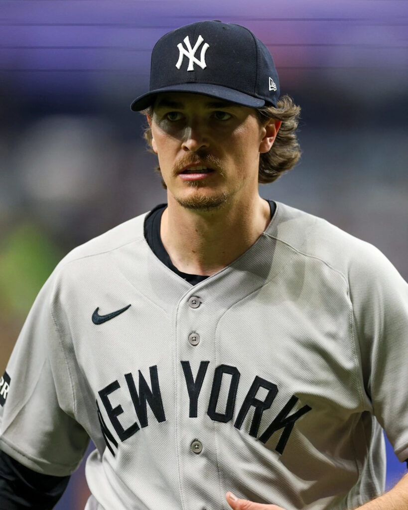 Yankees ace Max Fried out with elbow injury, what’s next?
