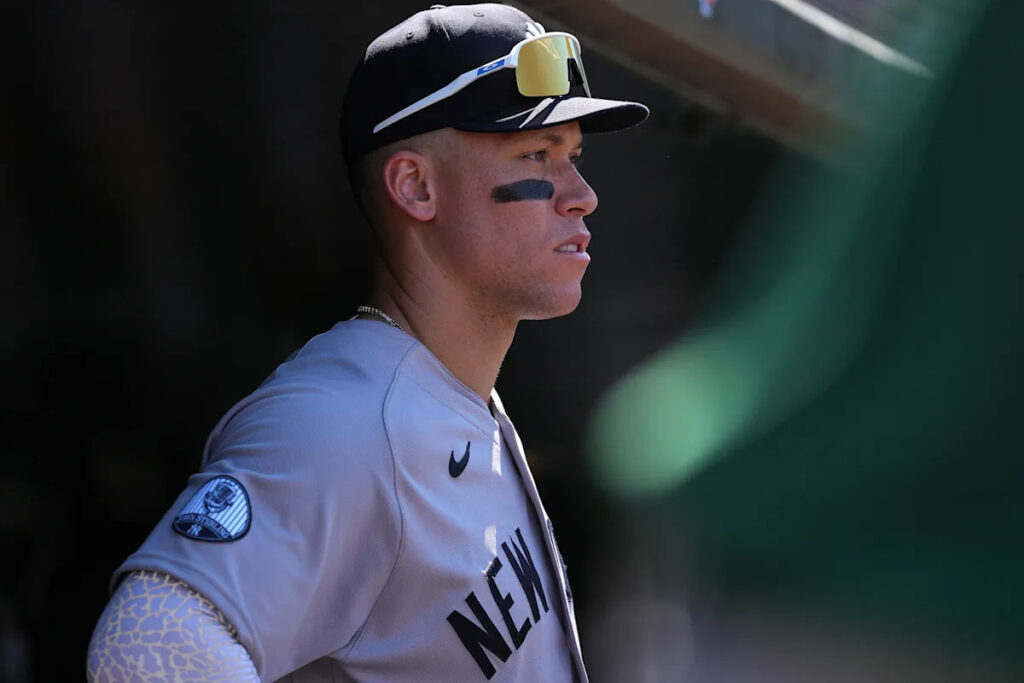 Yankees star Aaron Judge has bone bruise, will meet with doctors Tuesday night