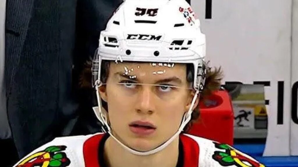 Is Connor Bedard REALLY Worth  Million?